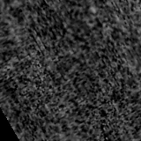 F115W image, 3.2 arcsec across, north up